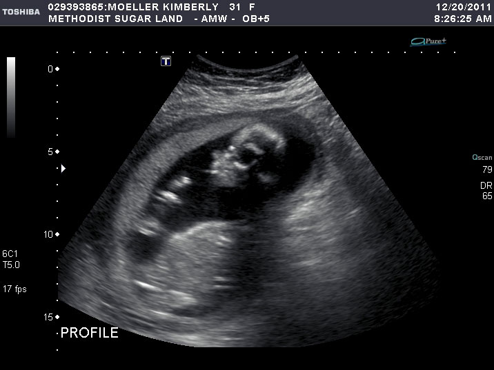ultrasound image one